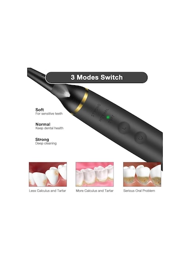 Valkyrie Ultrasonik Taşınabilir Diş Taşı Diş Lekesi Tartar Temizleme