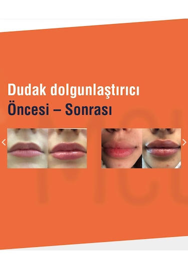 Meleys Bold Plus Plumping Lip Gloss Dudak Dolgunlaştırıcı 0
