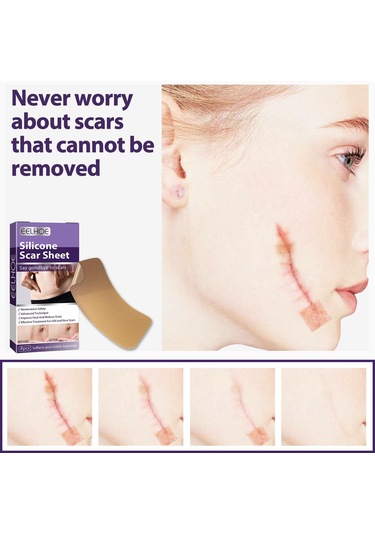 Dolıty Yanık İzleri Skar Yaması Çok Kullanımlı Yumuşak