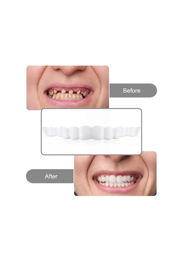 Hangfox Geçici Diş Kaplama, Üst Ve Alt Dişler İçin Dekoratif Protez, Kolay Takılabilir, Hemen Düzenli Parlak Dişler, Güvenli Konforlu Malzeme