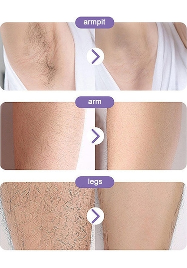 Nano-cam Epilasyon Fiziksel Ağrısız Güvenli Epilatör Metal Gül Altın