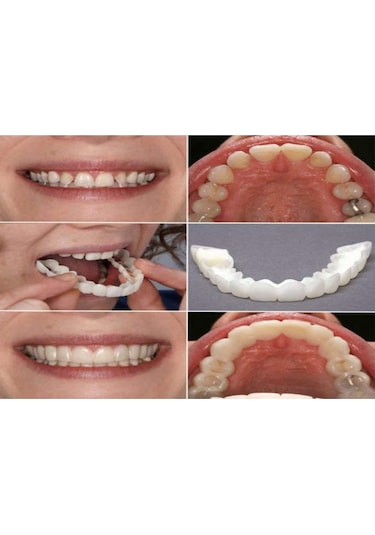 Hangfox Geçici Diş Kaplama, Üst Ve Alt Dişler İçin Dekoratif Protez, Kolay Takılabilir, Hemen Düzenli Parlak Dişler, Güvenli Konforlu Malzeme