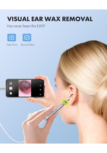 Anykit Dijital Otoskop, Ultra Net Görüşlü Kulak Kamerası - İpad/iphone/android