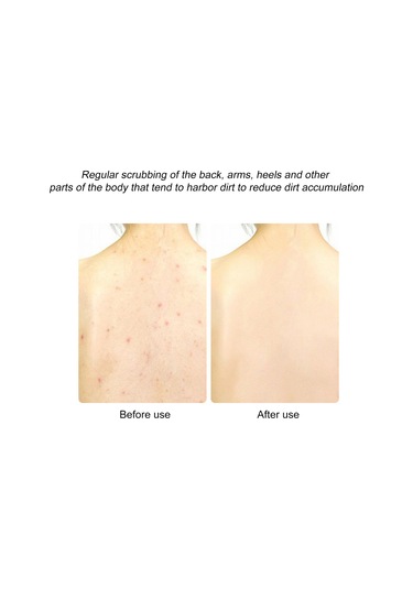 Vkemall Renkli Banyo Lif Takımı - Mor, Mavi, Kahverengi, 3'lü Set, Yıkama Ve Peeling İçin İdeal