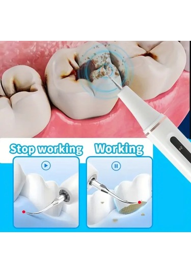 Willowhaven Usb Şarjlı Led Diş Temizleme Seti - 5 Hızlı Beyaz Diş Bakım Aleti Ek Uçlu Seyahat