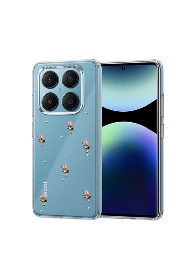 Redmi Note 14 Pro 4g Fiyonk Desenli Kapak - Desen 6 Bzsxx00 1