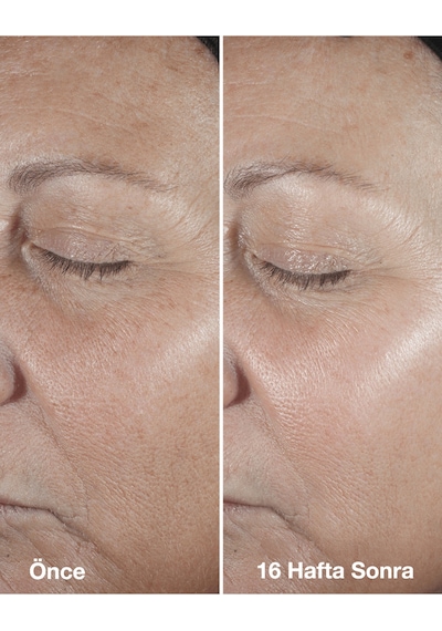 Çizgi Ve Kırışıklık Görünümü Karşıtı Onarıcı Ve Yenileyici Smart Clinical Repair Serum 75 Ml