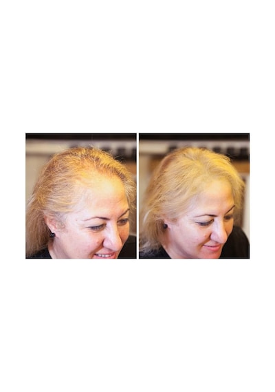 Fixplant 1 Şişe 28 Gr. Saç Dolgunlaştırıcı Topik Siyah