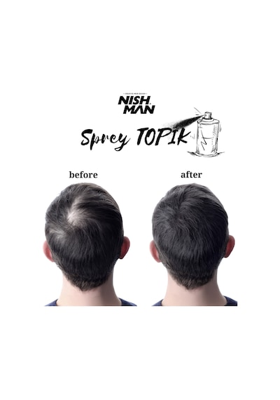 Root Touch Up Sprey / Saç Dolgunlaştırıcı Ve Seyrek Kapatıcı Sprey Topik/ Suda Yağmurda Akmaz 100 Ml