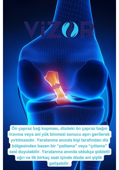 Code: 506 Ön Çapraz Bağ Destekli Dizlik Siyah