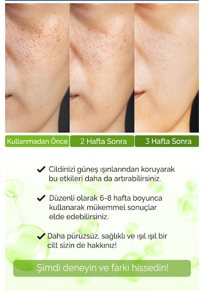 Siyah Nokta Karşıtı Ve Leke Karşıtı Yüz Bakım Serumu 2 Li Set