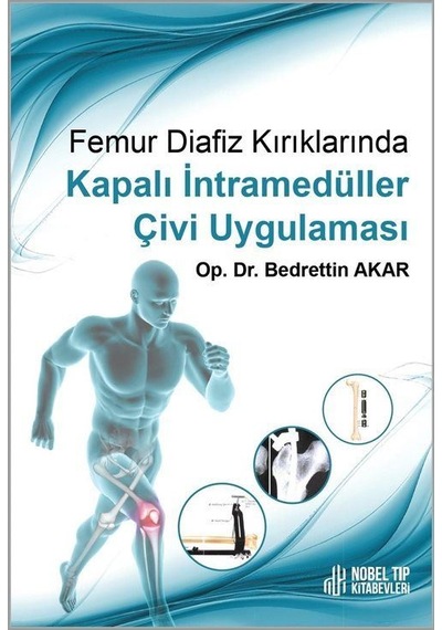 Femur Diafiz Kırıklarında Kapalı I Ntramedu Ller C İvi Uygulam...