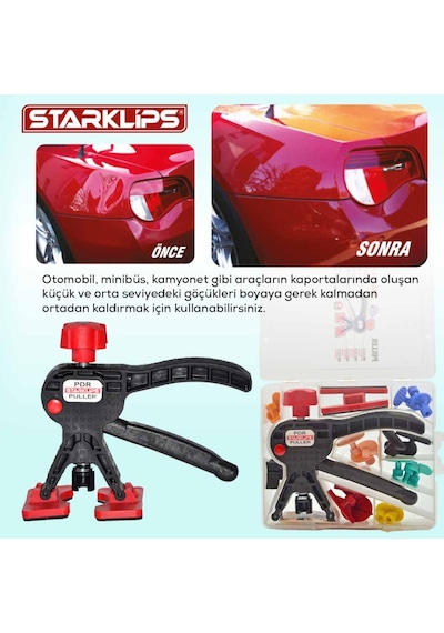 Boyasiz Göçük Düzeltme Set Çanta Pensesi Renkli + 24 Adet Pdr Göç 110877704