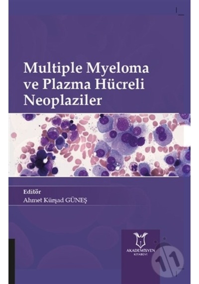 Multiple Myeloma Ve Plazma Hücreli Neoplazilerde 2019 Güncellemes