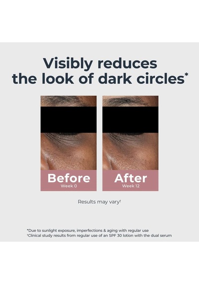 Eucerin Radiant Tone Koyu Leke Göz Kremi 14gr