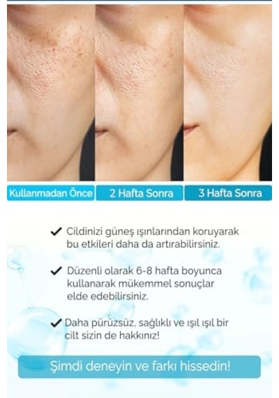 Nemlendirici Aydınlatıcı Hyaluronique Premium Serum Aura Series A250