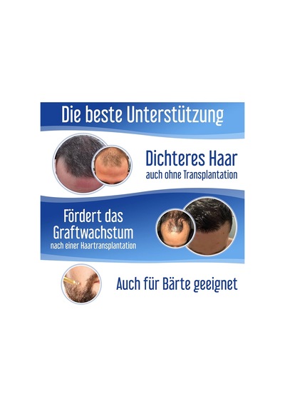 Depnipharma Hair Forte Erkek Engelleyici Sprey 60 Ml