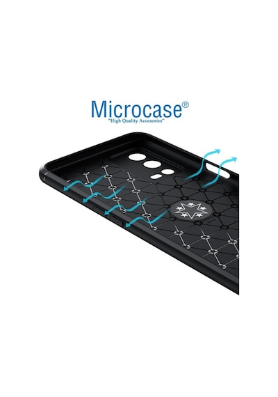 Microcase Oppo A55 Focus Serisi Yüzüklü Kilif - Siyah 536339400