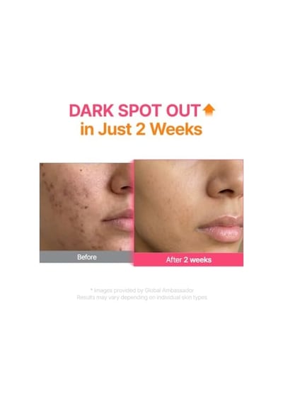 Purito Txa 6 Niacinamide 10 Retinal Serum