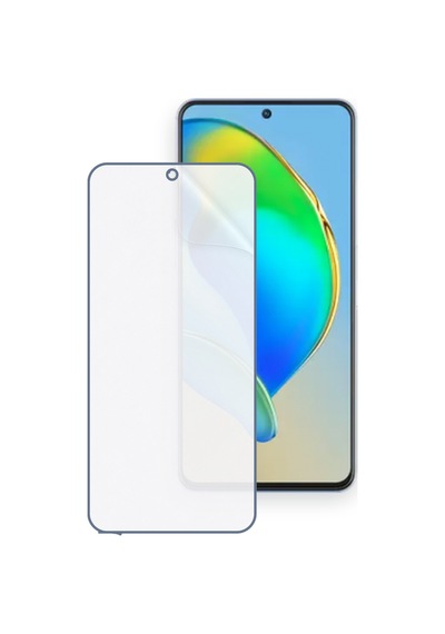 Axon 40 Se Uyumlu Ön Yüzey Nano Şeffaf Hidrojel Ekran Koruyucu 86272022