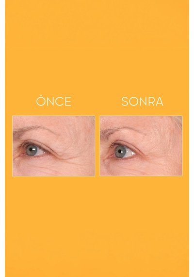 Elizabeth Arden Prevage Progressive Renewal Treatment Aşamalı Cilt Yenileyici Peeling Serum 4 x 10 ML﻿﻿