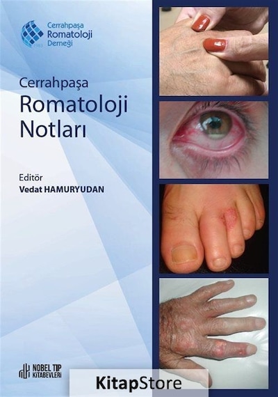Cerrahpaşa Romatoloji Notları- Nobel Tıp Kitabevleri