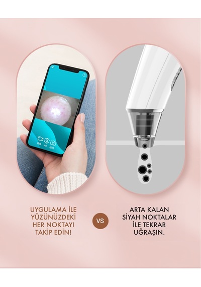 X-Level X-Shinysmart Wi-fi Kameralı Siyah Nokta Temizleme Cihazı