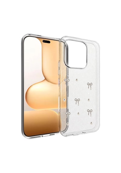 Newface Huawei Honor 600 Lite Fiyonk Desenli Kapak - Desen 5