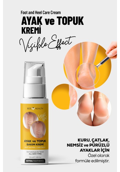 Ayak Ve Topuk Çatlak Bakım Kremi 100 Ml Kuru, Sertleşmiş Ve Pürüzlü Ayaklar İçin
