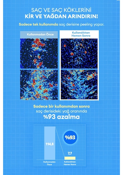 Arındıran, Nemlendiren, Hacim Veren Saç Bakım Seti Kundal Airy Volume Hyaluron Shampoo + Treatment