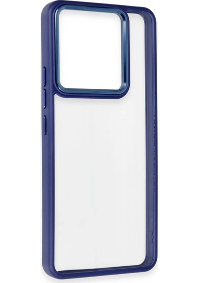 Newface - 863 - Xiaomi Redmi Note 13 Pro 5g Kılıf Power Silikon - Csmo-tex - - Lacivert