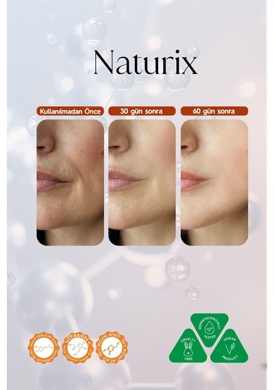 Naturix Kojik Asit Yüz Bakım Kremi - Leke Karşıtı, Aydınlatıcı, Cilt Tonu Eşitleyici, Niacinamide 50ml