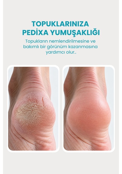Dermani Pedixa Topuk Bakım Kremi 75 ML