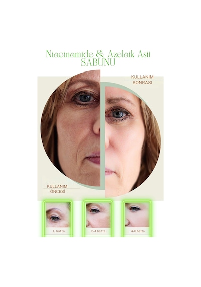 Niacinamide Sabunu, Azelaik Asit Cilt Aydınlatıcı Siyah Nokta Gözenek Çay Ağacı Anti Acne 1 Adet