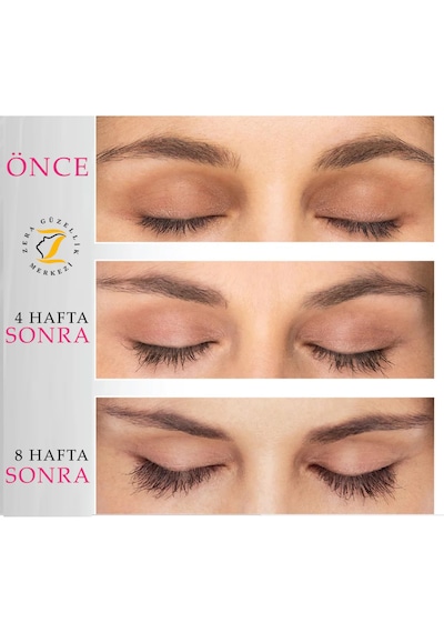 Hairplus X10lash Kirpik Ve Kaş Serumu 01 Açık