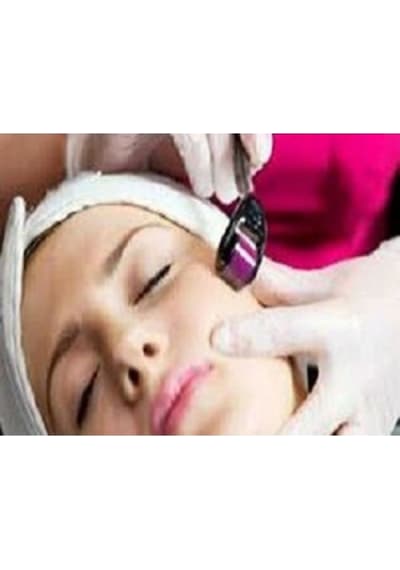 Titanyum 540 İğneli Derma Roller 1 MM