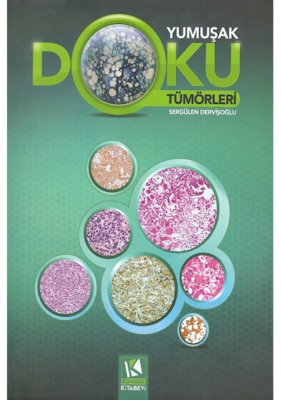 Yumuşak Doku Tümörleri