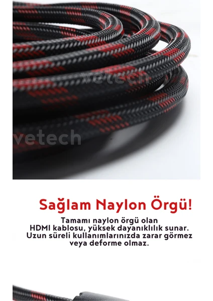 Vetech Hdmı Kablo 1.5 Metre Örgü Sargılı Dayanıklı Full Hd Televizyon / Monitör / Tv Hdmi Kablosu 1,5 Metre