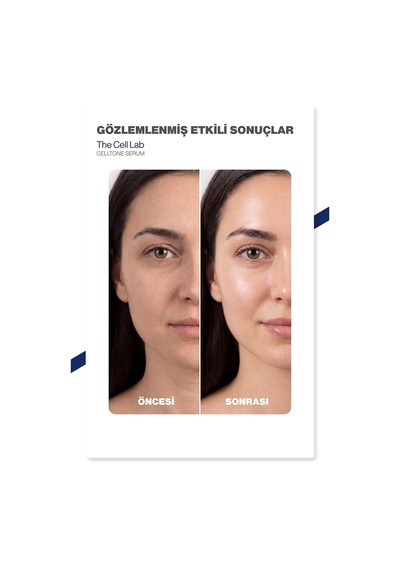 Bariyer Onarıcı & Nemlendirici Yüz Serumu, Pdrn, 50ml