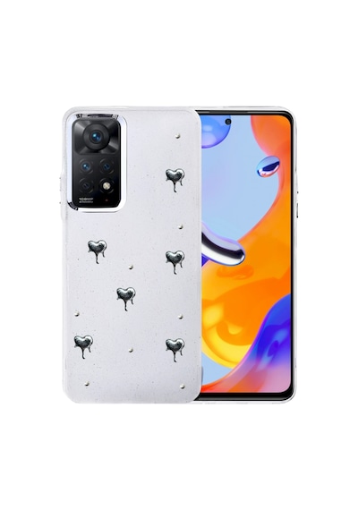 Newface - 927 - Xiaomi Redmi Note 11 Pro Fiyonk Desenli Kapak - - Spt-gld - Desen 1 Diğer