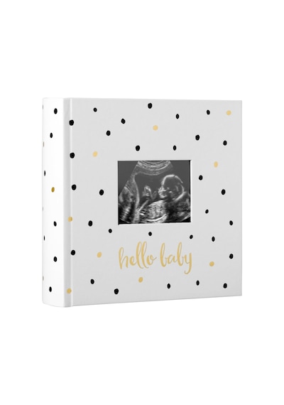 Pearhead Hello Baby Fotoğraf Albümü, Yeni Ve Bekleyen Ebeveynler İçin Bebek Kitabı Hatırası, Cinsiyetsiz Bebek Ak Genel