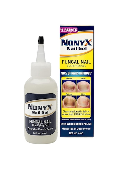 Nonyx Nail Gel 113 G