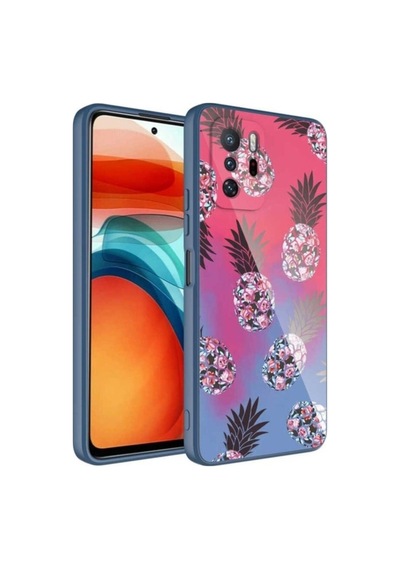 Xiaomi Redmi Note 10 Pro Kılıf Kamera Korumalı Desenli Sert Silikon Zore Epoksi Kapak NO3