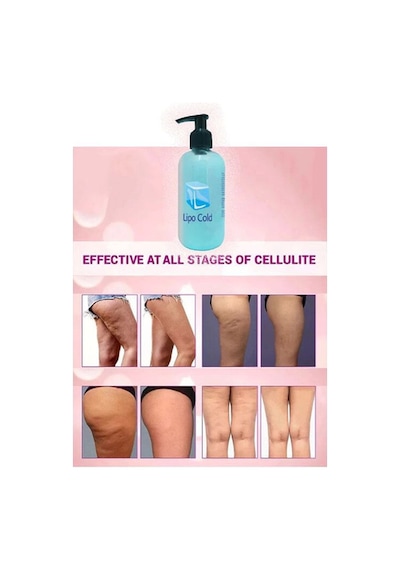 Lıpo Cold Selulitlerinize Karşı Bakım Ve Masaj Kremi 250 Ml X 2 Ad.