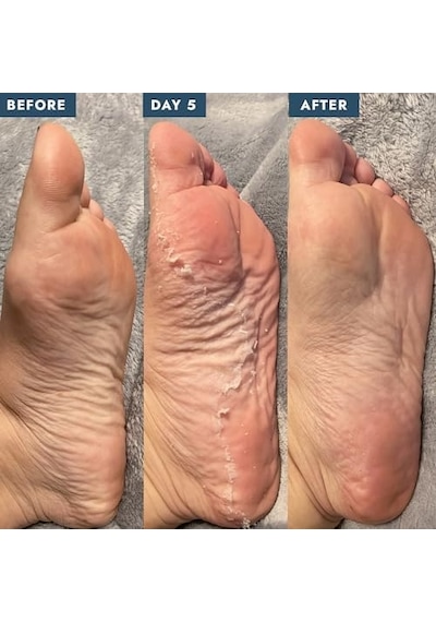 Peeling Bakım Çorabı 40 Ml