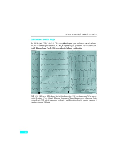 Normal Ve Patolojik Pediatrik Ekg Atlası