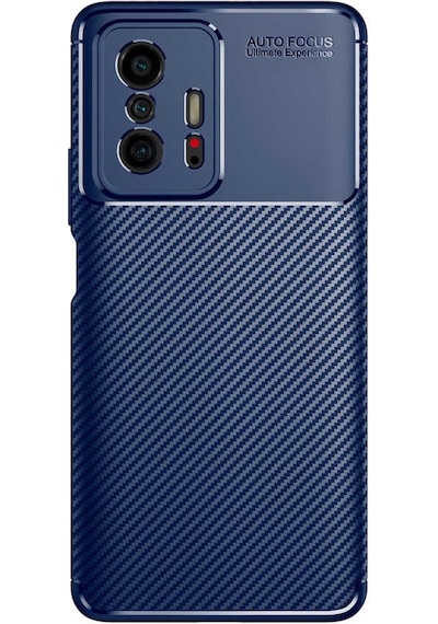 Xiaomi Mi 11T Pro Kilif Lens Karbon Tasarim Negro Silikon Kapak 522480108