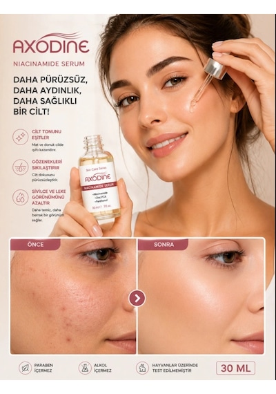 Axodine Gözenek Sıkılaştırıcı Sivilce Leke Ve Siyah Nokta Karşıtı Niacinamide Serum 30 ML