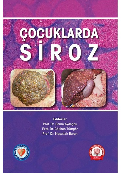 Çocuklarda Siroz