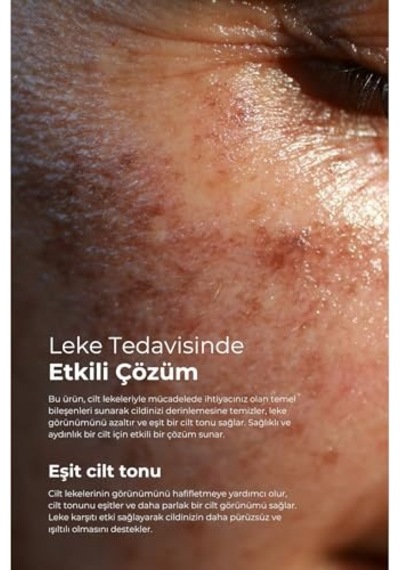 Clinic Leke Kremi 75ml + Dermodicos Plus Krem 30ml